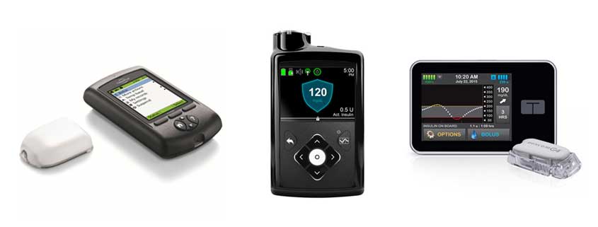 MiniMed 670G Insulin Pump System with Guardian CGM Technology